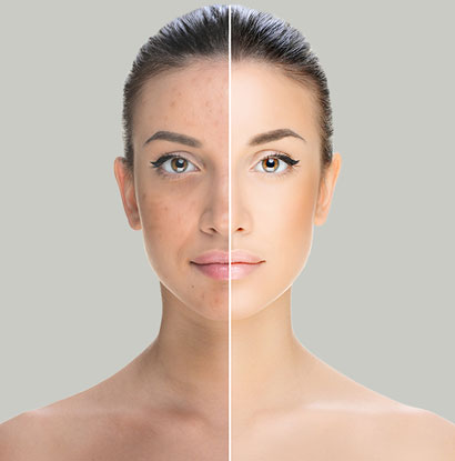Pigment Removal Melbourne Pigment Removal Melbourne