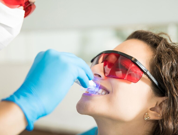 Laser Teeth Whitening Treatment Melbourne Laser Teeth Whitening Treatment Melbourne