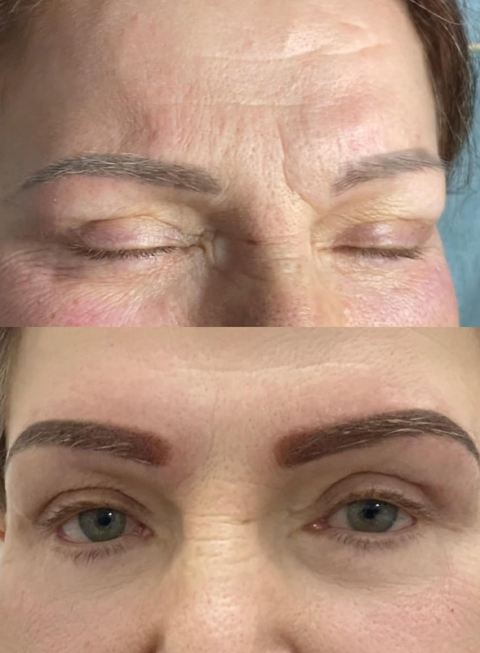 Eyebrows Tattoo Correction Melbourne Eyebrows Tattoo Correction Melbourne