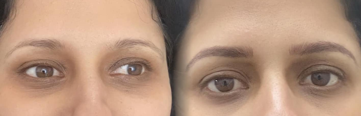 Best Feathering Eyebrows Melbourne Best Feathering Eyebrows Melbourne