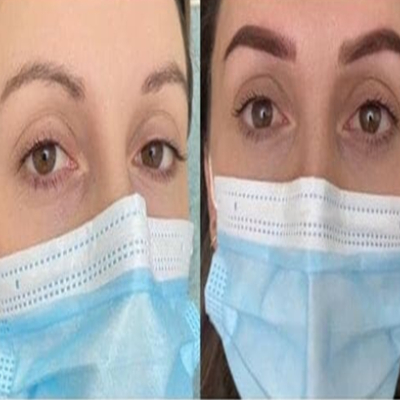 Before and After Eyebrow Tattoo Service Before and After Eyebrow Tattoo Service